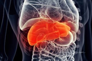Fatty Liver: Are You Part of the 1 in 3 Affected by This Silent Epidemic?