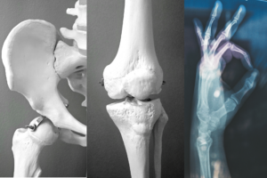 Biohack: Nutrition for Stronger Bones