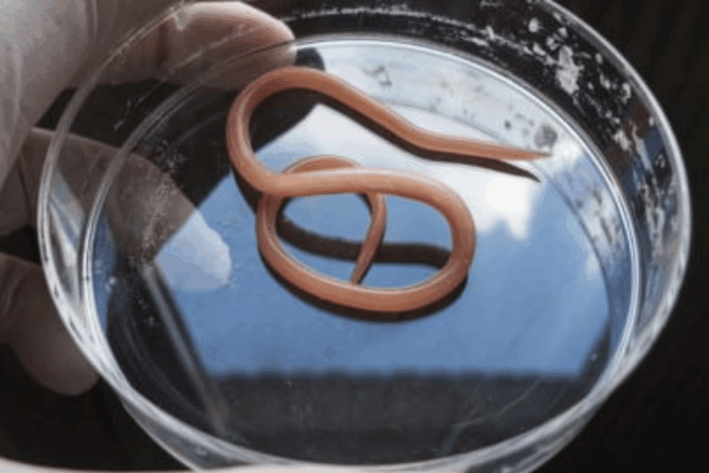 Parasites: How To Scare Them Away